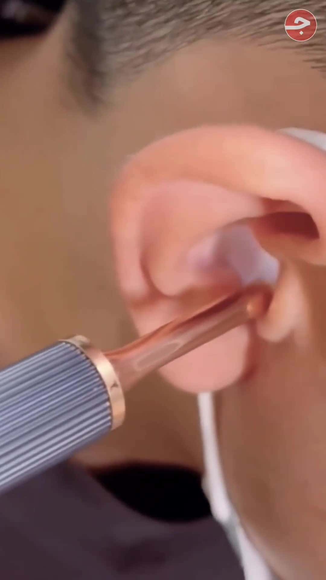 BEBIRD X17 PRO Smart Ear Wax Removal Device