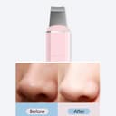 Xiaomi inFace Ultrasonic - Ion Skin Purifier