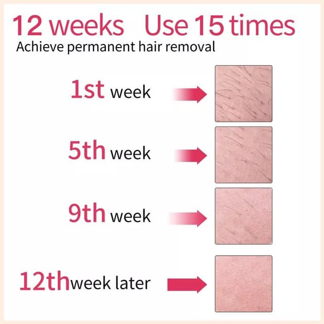 جهاز الليزر المنزلي 400000 ومضة ليسكولتون Lescolton 400,000 flashes Ipl Hair Removal