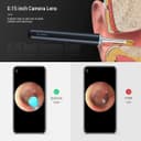 BEBIRD X17 PRO Smart Ear Wax Removal Device