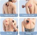 Zdeer Cupping Therapy Massager and Heating Cupping Set