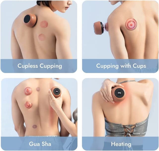 Zdeer Cupping Therapy Massager and Heating Cupping Set