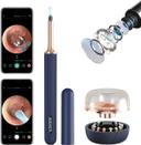 جهاز تنظيف الاذن اللاسلكي بيبيرد مع كاميرا Bebird Note 5 Pro Ear Wax Removal with Camera
