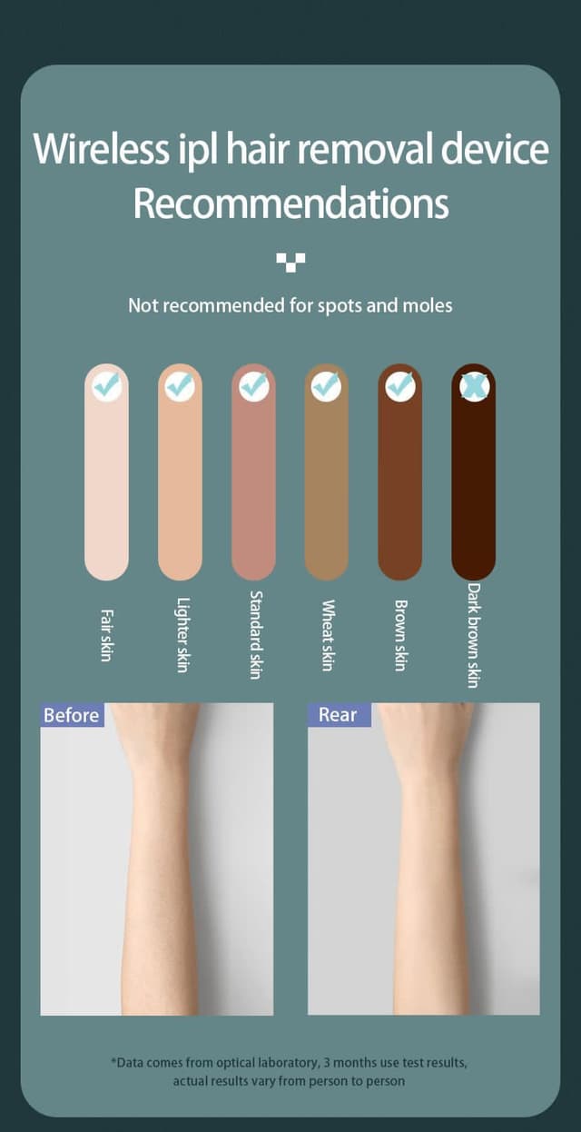 جهاز ليزر منزلي لازالة الشعر IPL Laser Hair Removal Device