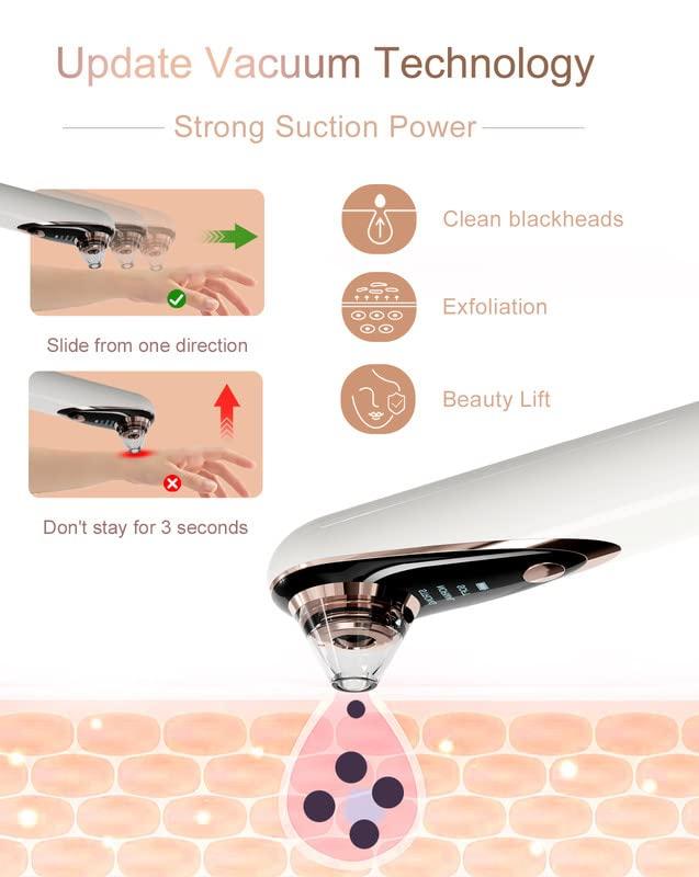 Jisszhou Blackhead Remover Vacuum with Camera And 4 Suction Heads