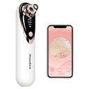 Jisszhou Blackhead Remover Vacuum with Camera And 4 Suction Heads