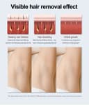 جهاز ليزر منزلي لازالة الشعر ليسكولتون 350000 ومضة Lescolton IPL Permanent Hair Remover For Home Use