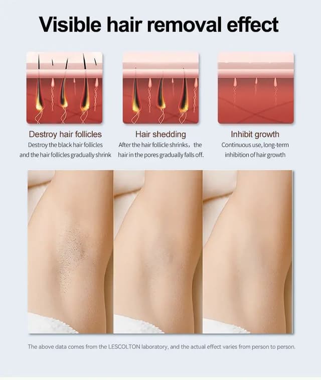 جهاز ليزر منزلي لازالة الشعر ليسكولتون 350000 ومضة Lescolton IPL Permanent Hair Remover For Home Use