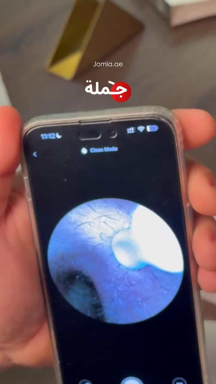 جهاز تنظيف الاذن لاسلكي بيبيرد مع كاميرا مدمجة 1080 بكسل Bebird Earsight Plus I35R Ear wax removal Tool