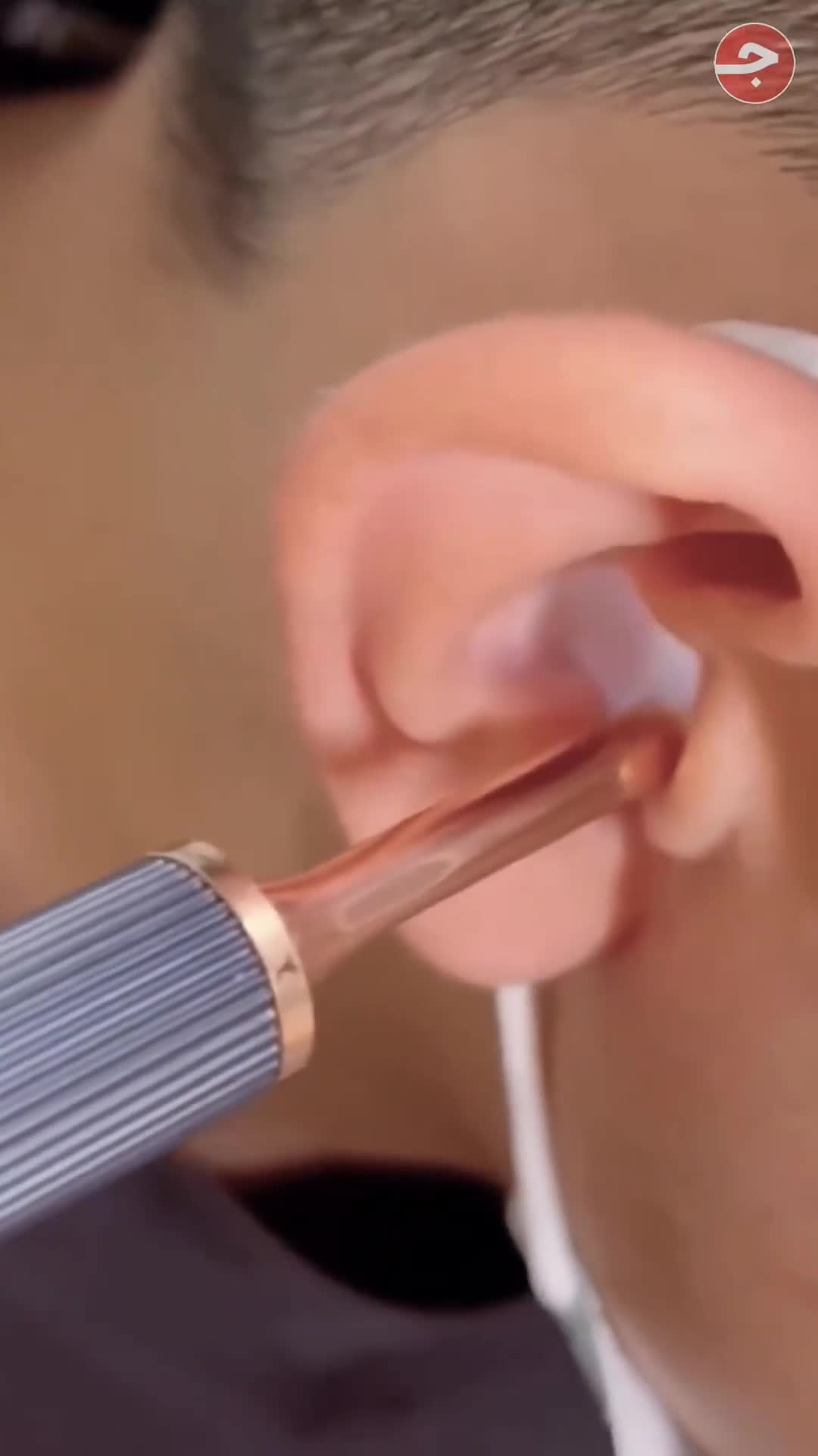 BEBIRD X17 PRO Smart Ear Wax Removal Device