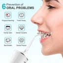 جهاز خيط الاسنان المائي محمول 2000 مللي أمبير 300 مللي Portable Oral Irrigator Water Flosser