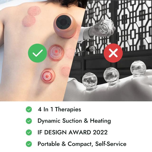 جهاز الحجامة الذكي والتدليك الكهربائي (الجواشا) Zdeer Cupping Therapy Massager and Heating Cupping Set - SW1hZ2U6NzA5NzIz