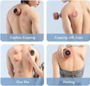 Zdeer Cupping Therapy Massager and Heating Cupping Set - SW1hZ2U6NzA5NzI1